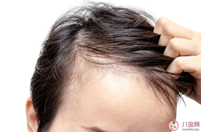 所有脱发人士都适合做植发手术吗 蚂蚁庄园8月16日正确答案