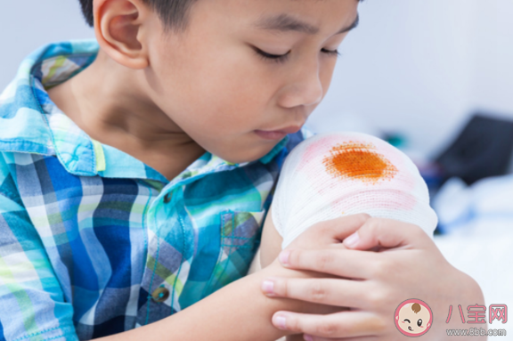 孩子摔跤后怎么判断有没有骨折 孩子摔伤了怎么正确处理