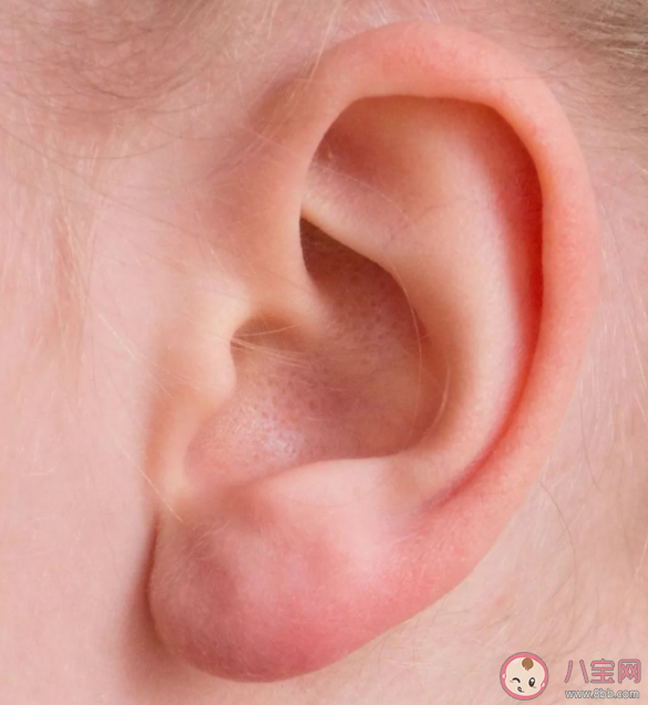 虫子进了耳朵用手电筒照是好办法吗 蚂蚁庄园8月19日正确答案