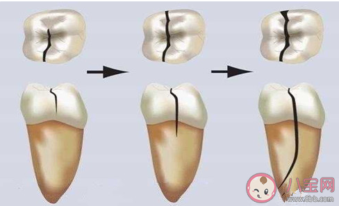 蚂蚁庄园虫牙是因为牙齿中有虫吗 8月20日答案介绍