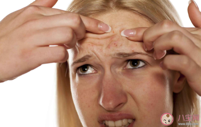 人为什么会长痘痘 长了痘痘一定要注意的8件事 人为什么会长痘痘 长了痘痘一定要注意的8件事