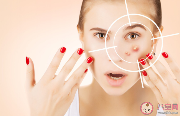 人为什么会长痘痘 长了痘痘一定要注意的8件事 人为什么会长痘痘 长了痘痘一定要注意的8件事