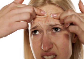 人为什么会长痘痘 长了痘痘一定要注意的8件事