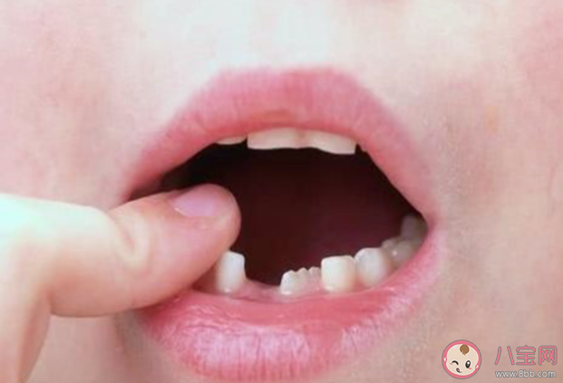 摔跤后牙齿掉落怎么处理 牙齿磕掉了一小块怎么办