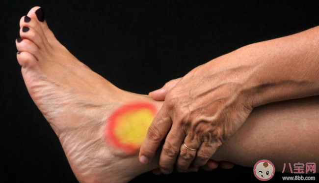 扭伤都可以用红花油吗 扭伤是该热敷还是冷敷 扭伤都可以用红花油吗 扭伤是该热敷还是冷敷