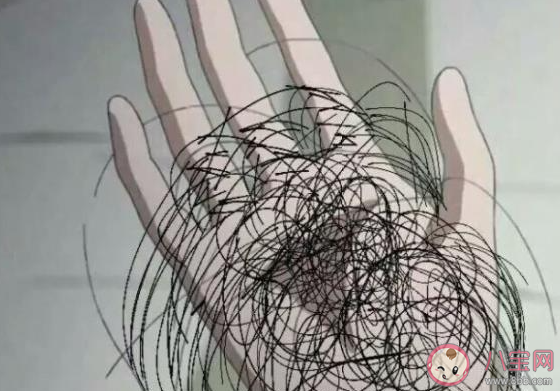 为什么年纪轻轻就脱发 怎样防止脱发 为什么年纪轻轻就脱发 怎样防止脱发