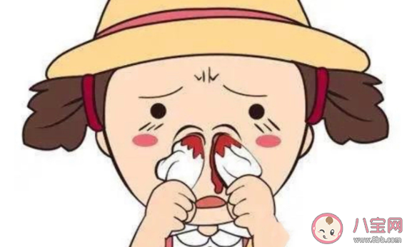 流鼻血时最科学合理的止血方式是什么 哪些方法不建议采用
