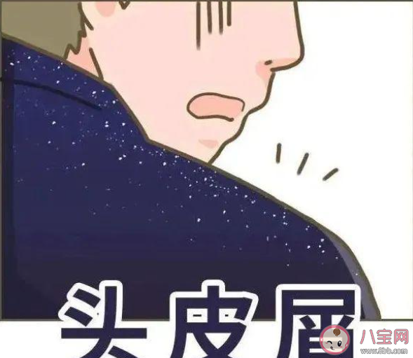 如果把头发剃光还会不会有头皮屑 蚂蚁庄园9月15日答案 如果把头发剃光还会不会有头皮屑 蚂蚁庄园9月15日答案