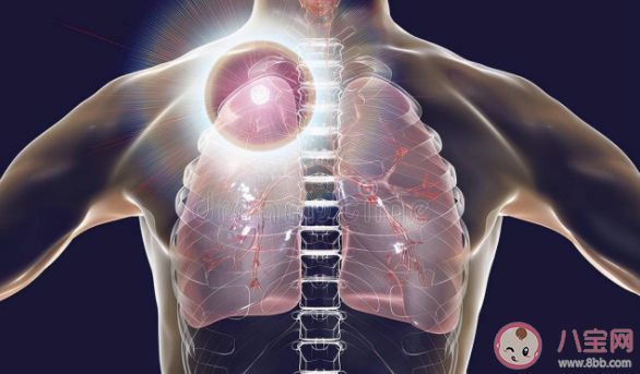 肺结节和肺癌有什么关系 为什么发现肺结节的人越来越多