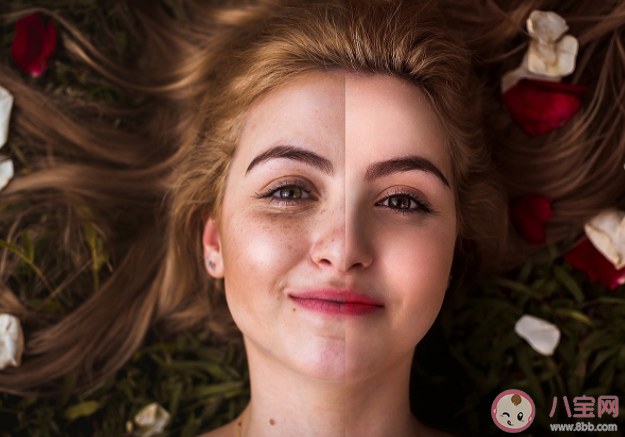 老年斑多大年纪的人长算正常 如何改善长斑的问题