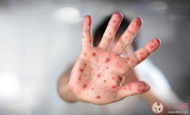 中秋国庆假期健康方面需注意哪些 中秋国庆出行个人防控五点建议 