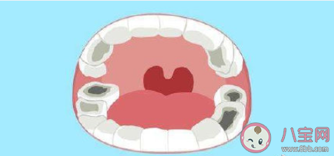 蛀牙真的和吃糖有关吗 如何防止蛀牙 蛀牙真的和吃糖有关吗 如何防止蛀牙