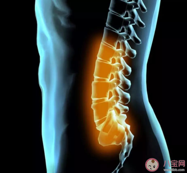 腰椎间盘突出症什么时候需要手术 腰腿痛是腰椎间盘突出症吗