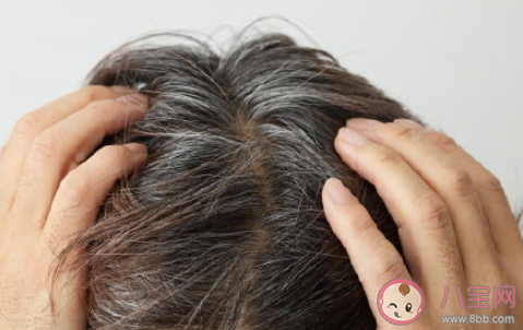 年纪轻轻就长白头发是肾不好吗 白头发多该怎么办