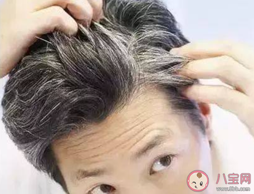 年纪轻轻就长白头发是肾不好吗 白头发多该怎么办