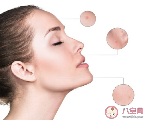 换季时期皮肤状态差怎么办 换季的时候如何护肤