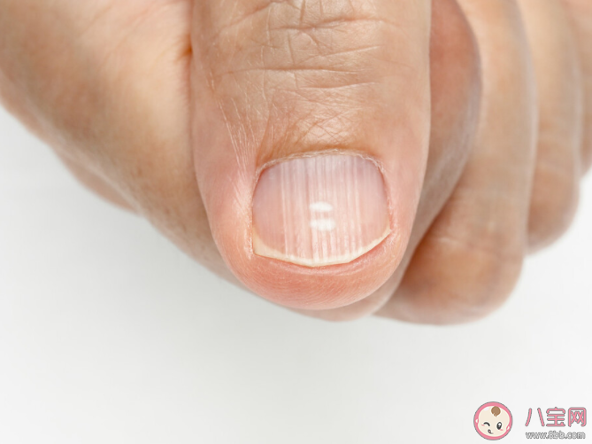 指甲上有竖纹是身体有大病的征兆吗 蚂蚁庄园11月5日正确答案 指甲上有竖纹是身体有大病的征兆吗 蚂蚁庄园11月5日正确答案