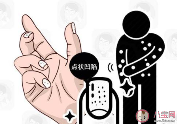 蚂蚁庄园指甲上有竖纹是身体有大病的征兆吗 11月5日答案介绍 蚂蚁庄园指甲上有竖纹是身体有大病的征兆吗 11月5日答案介绍