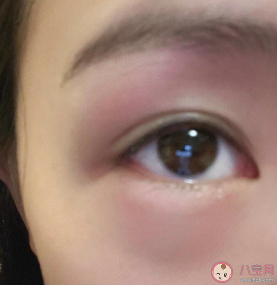 大哭之后眼睛会肿主要是因为什么 蚂蚁庄园11月10日答案