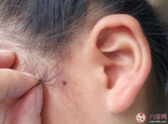 用药不当和用眼过度哪个是导致耳聋的因素 蚂蚁庄园12月3日正确答案 用药不当和用眼过度哪个是导致耳聋的因素 蚂蚁庄园12月3日正确答案