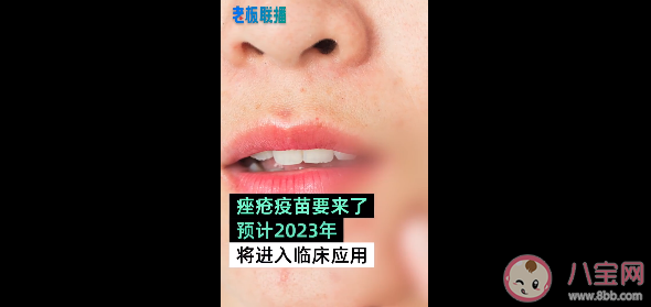 青春痘疫苗什么时候可以打 只有青春期才会长痘痘吗