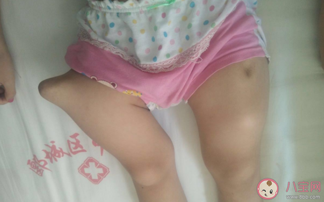 瓷娃娃病友可以正常上学工作吗 蚂蚁庄园12月7日正确答案 瓷娃娃病友可以正常上学工作吗 蚂蚁庄园12月7日正确答案