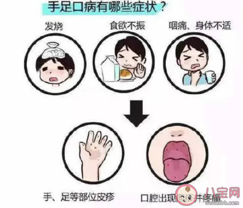 手足口高发期孩子应该如何防范 手足口病是什么原因引起的