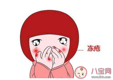 冬天如何有效预防冻疮 长冻疮了该怎么办 冬天如何有效预防冻疮 长冻疮了该怎么办