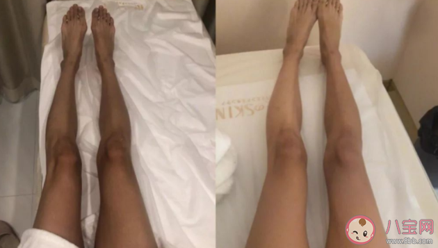 美白舱真的美白吗有没有效果 美白谣言区