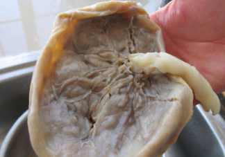 胎盘大补究竟是传言还是真的 胎盘如何处理比较好