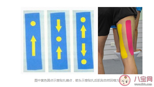 哪些情形可以用肌内效贴 肌贴到底应该怎么用