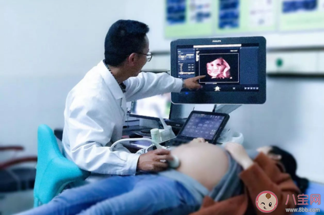胎母输血综合征是什么疾病 胎母输血综合征病因是什么