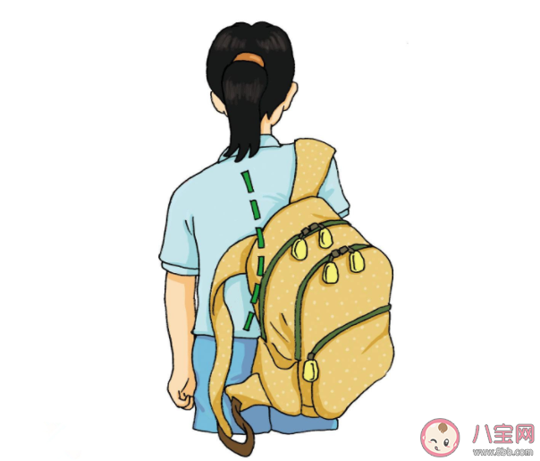 脊柱侧弯需要手术吗 脊椎侧弯会引起瘫痪吗