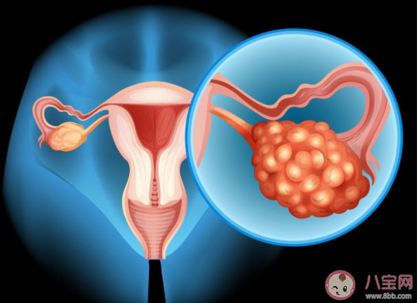 卵巢功能衰退会增加早死风险 卵巢功能衰退还会带来什么问题