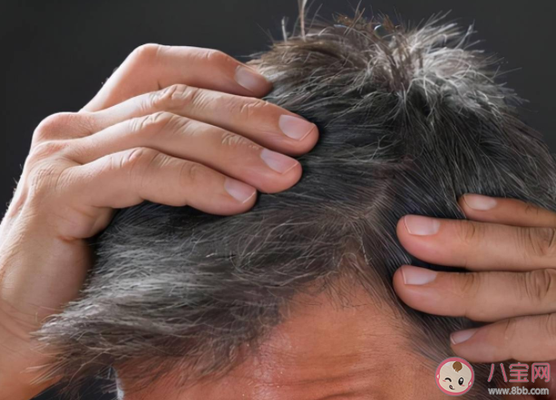 用特制的药水洗头可以重新长出白发是真的吗 白头发拔掉以后能长出黑发吗