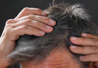 用特制的药水洗头可以重新长出白发是真的吗 白头发拔掉以后能长出黑发吗