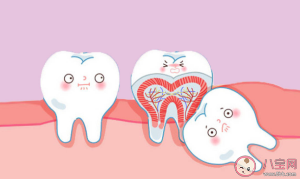 智齿是如何被拔出的 哪种智齿必须要拔