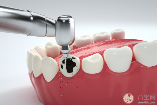 吃食物为什么总是容易塞牙 吃完东西就塞牙剔不出来怎么办 吃食物为什么总是容易塞牙 吃完东西就塞牙剔不出来怎么办