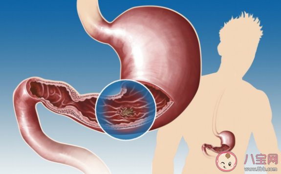 吃太多反而容易饿是怎么回事 脾胃不和有哪些症状 吃太多反而容易饿是怎么回事 脾胃不和有哪些症状