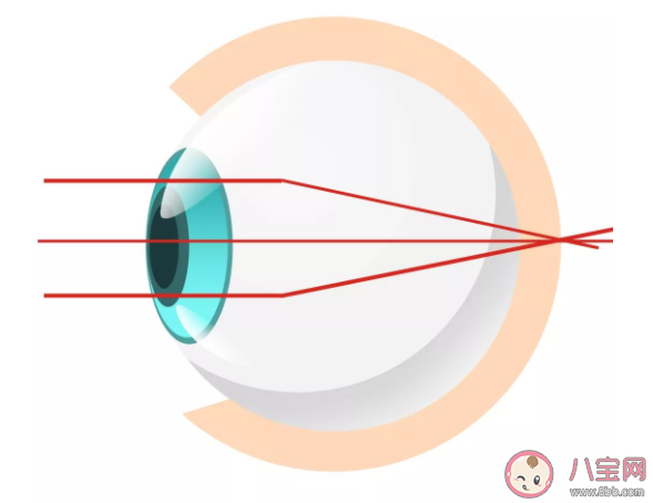 揉眼会造成散光吗 散光对眼睛影响大吗 揉眼会造成散光吗 散光对眼睛影响大吗