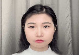 经常扎头发发际线会变高吗 为什么发际线会变高