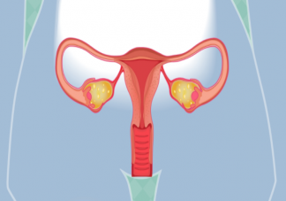 没结婚会得子宫内膜异位症吗 得了子宫内异症的人有哪些不适