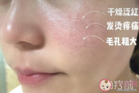 敏感肌脸红怕的是什么 敏感肌脸红该怎么办