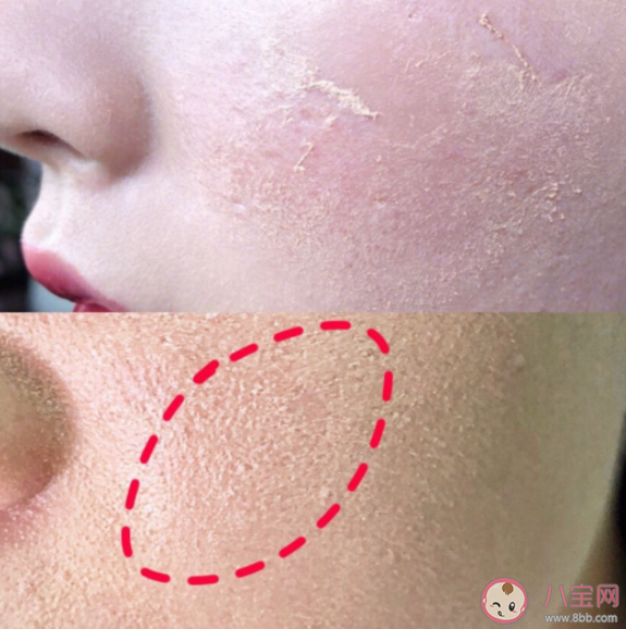 化妆卡粉严重是皮肤缺水吗 化妆卡粉浮粉的原因是什么