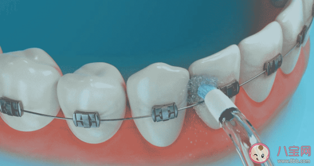 小朋友适不适合用儿童冲牙器 冲牙器适合哪些人群