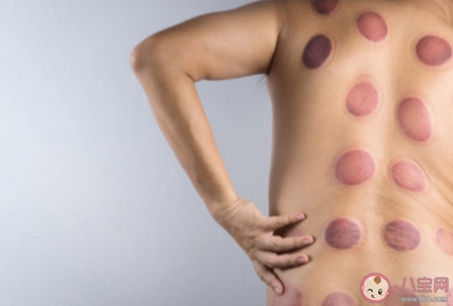 蚂蚁庄园拔罐后留下的印子越大说明效果越好吗 3月19日正确答案