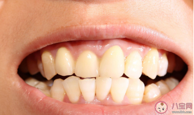 塞在牙缝里的肉丝最后会去哪儿 生活中该如何清理牙缝 塞在牙缝里的肉丝最后会去哪儿 生活中该如何清理牙缝