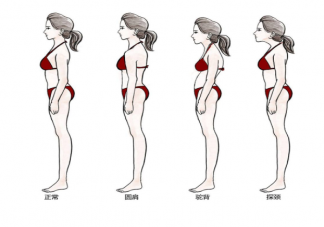 为什么现在越来越多人圆肩驼背 圆肩驼背怎么拯救颈椎