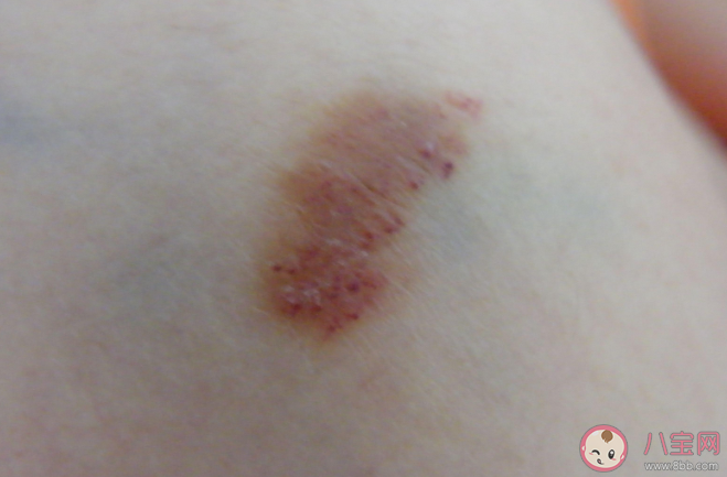 蚂蚁庄园有伤口不能吃酱油这种说法有科学依据吗 4月12日答案解析