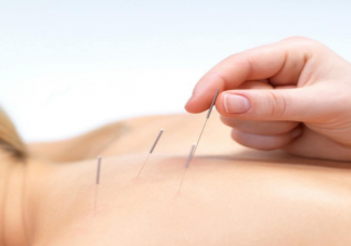 针灸后多久能洗澡 针灸有哪些禁忌